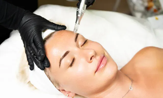 Medical Microneedling